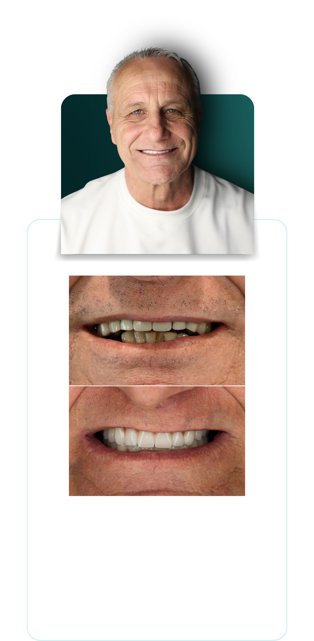 1 (3)